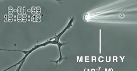 WATCH: VIDEO SHOWS WHAT MERCURY DOES TO A BRAIN NEURON IN JUST 20 MINUTES
